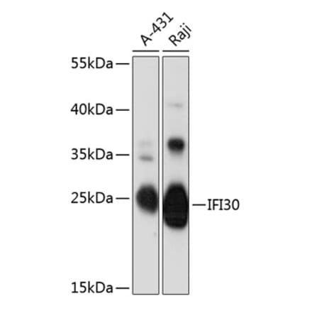 Western Blot - Anti-GILT Antibody (A89063) - Antibodies.com