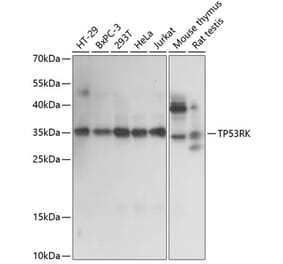 Western Blot - Anti-PRPK Antibody (A89064) - Antibodies.com