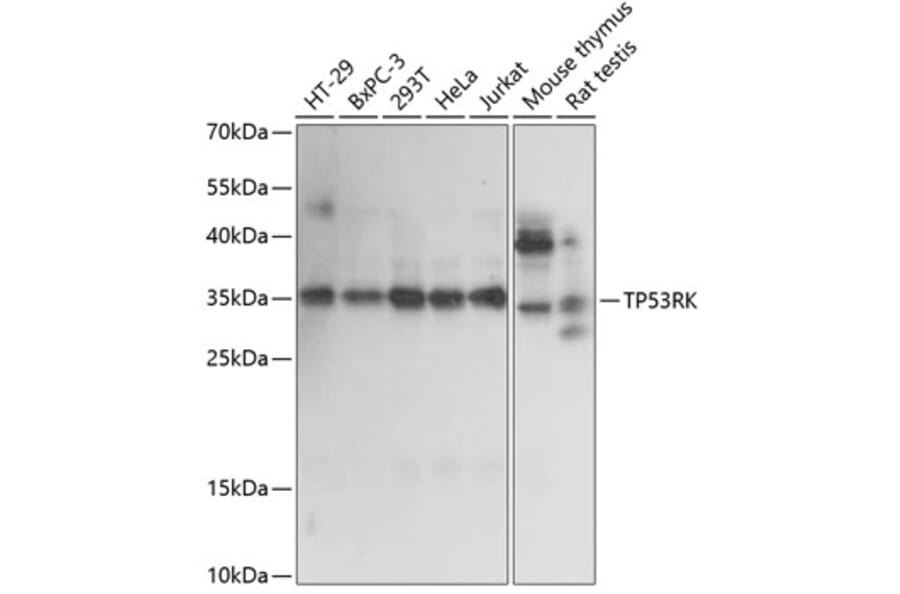 Western Blot - Anti-PRPK Antibody (A89064) - Antibodies.com