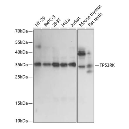 Western Blot - Anti-PRPK Antibody (A89064) - Antibodies.com
