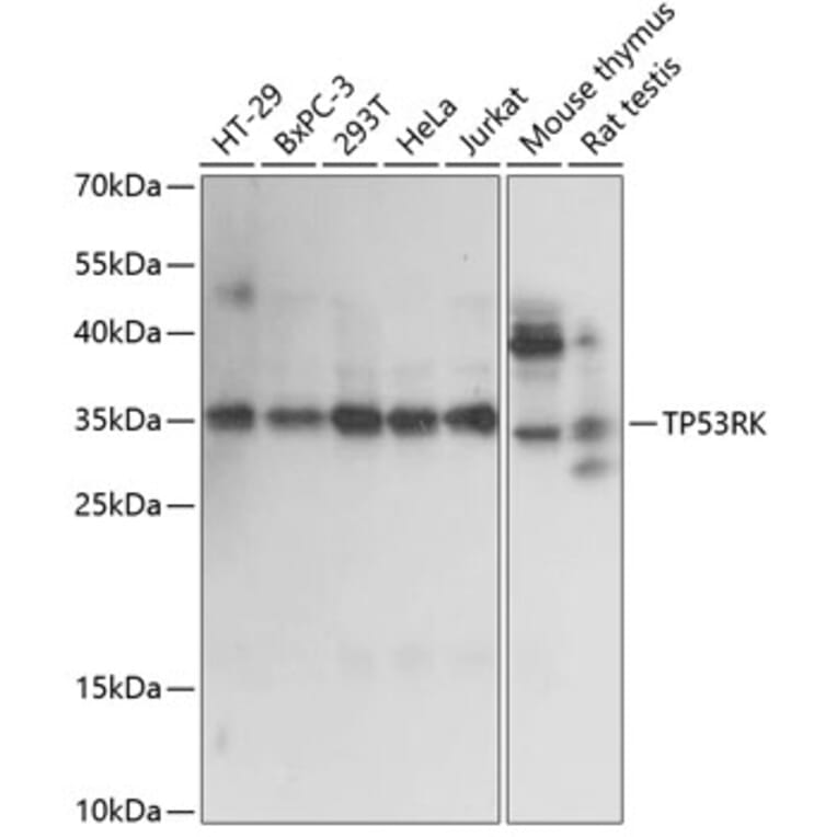 Western Blot - Anti-PRPK Antibody (A89064) - Antibodies.com