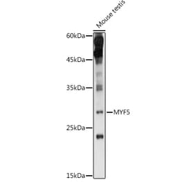 Western Blot - Anti-Myf5 Antibody (A89065) - Antibodies.com