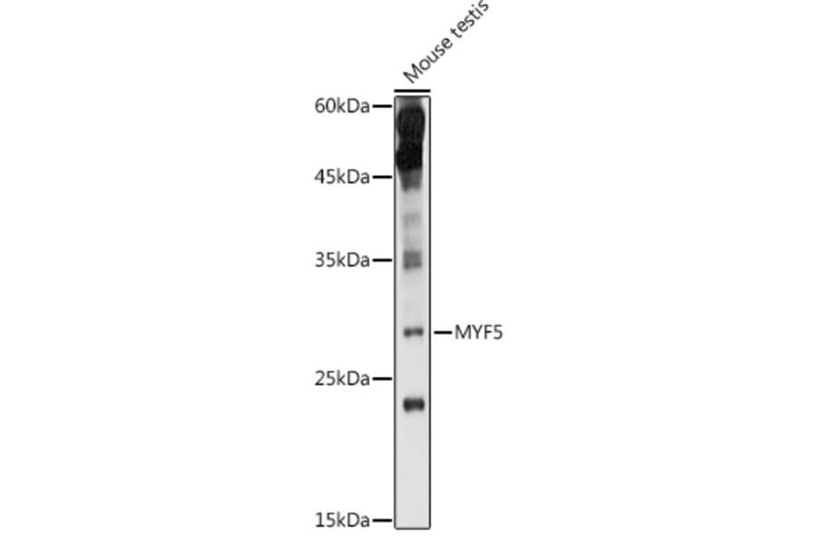 Western Blot - Anti-Myf5 Antibody (A89065) - Antibodies.com