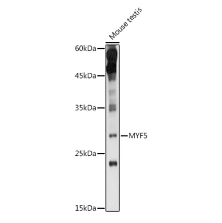 Western Blot - Anti-Myf5 Antibody (A89065) - Antibodies.com