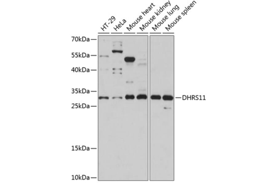 Western Blot - Anti-DHRS11 Antibody (A89066) - Antibodies.com