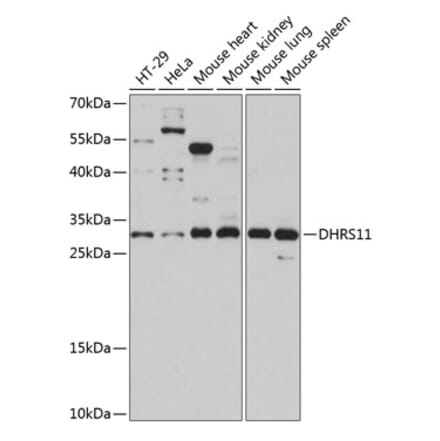 Western Blot - Anti-DHRS11 Antibody (A89066) - Antibodies.com