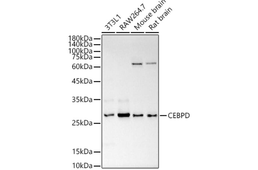 Western Blot - Anti-CEBP Delta/CEBPD Antibody (A89067) - Antibodies.com
