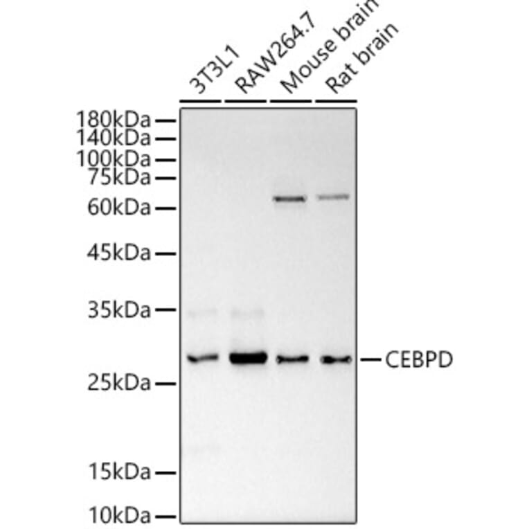 Western Blot - Anti-CEBP Delta/CEBPD Antibody (A89067) - Antibodies.com