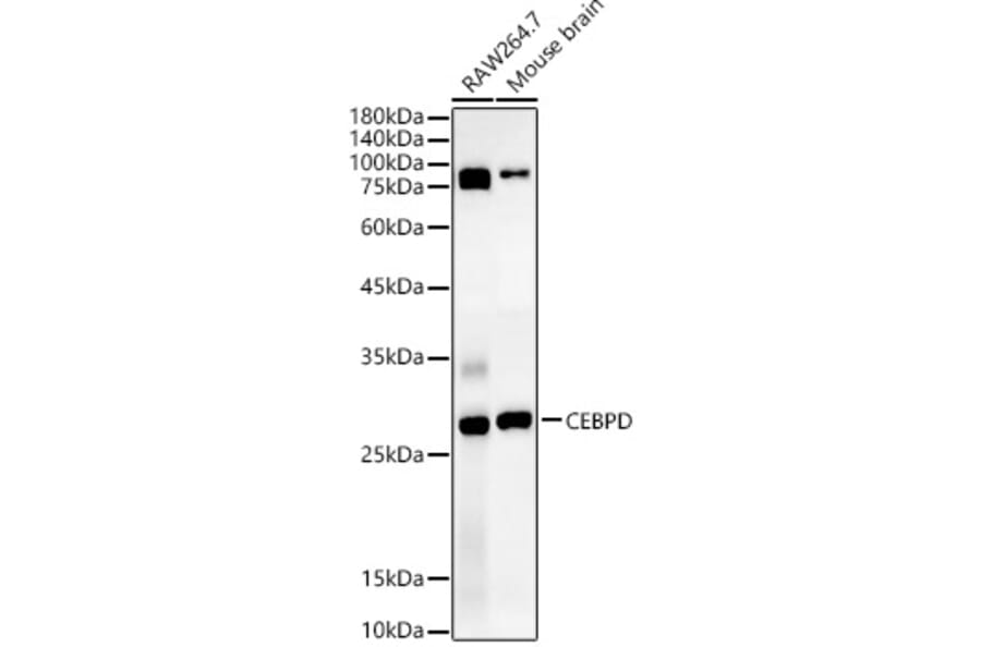 Western Blot - Anti-CEBP Delta/CEBPD Antibody (A89068) - Antibodies.com