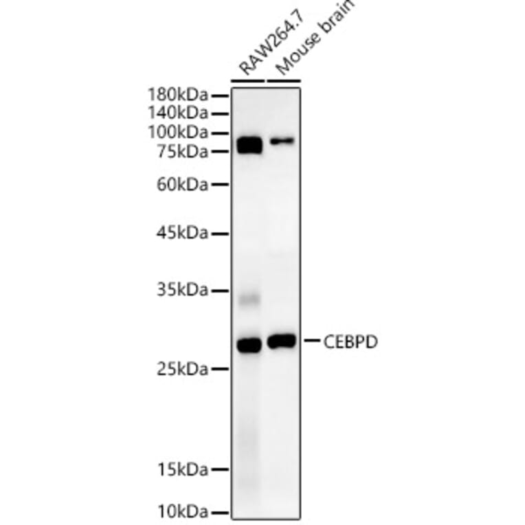 Western Blot - Anti-CEBP Delta/CEBPD Antibody (A89068) - Antibodies.com