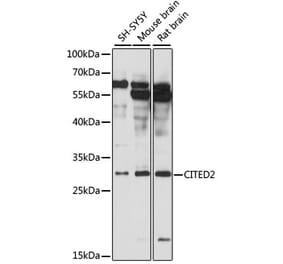 Western Blot - Anti-CITED2 Antibody (A89069) - Antibodies.com