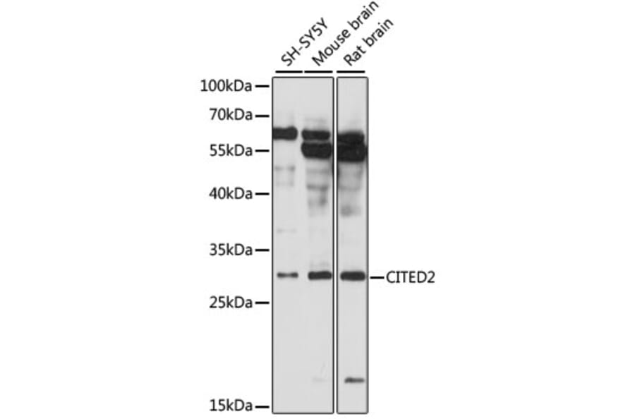 Western Blot - Anti-CITED2 Antibody (A89069) - Antibodies.com