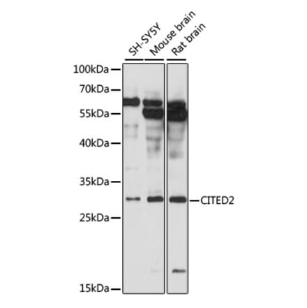 Western Blot - Anti-CITED2 Antibody (A89069) - Antibodies.com