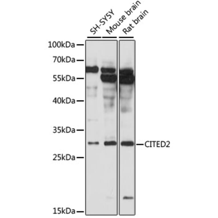Western Blot - Anti-CITED2 Antibody (A89069) - Antibodies.com