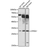 Western Blot - Anti-CITED2 Antibody (A89069) - Antibodies.com
