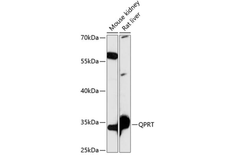 Western Blot - Anti-QPRT Antibody (A89070) - Antibodies.com
