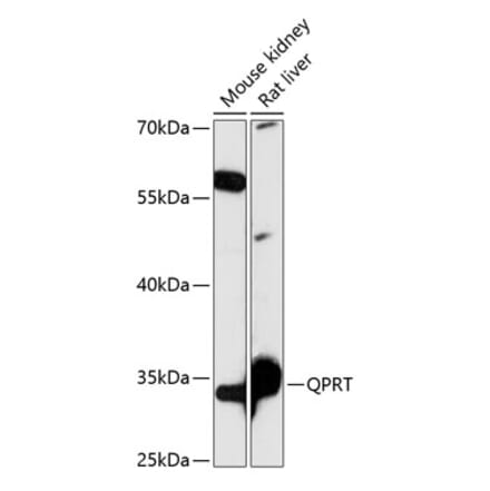 Western Blot - Anti-QPRT Antibody (A89070) - Antibodies.com