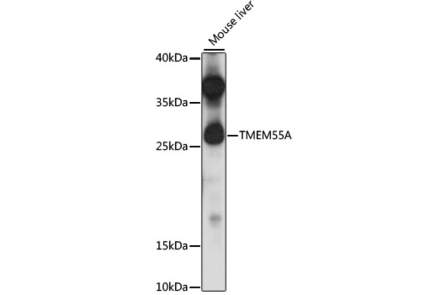 Western Blot - Anti-PIP4P2 Antibody (A89071) - Antibodies.com
