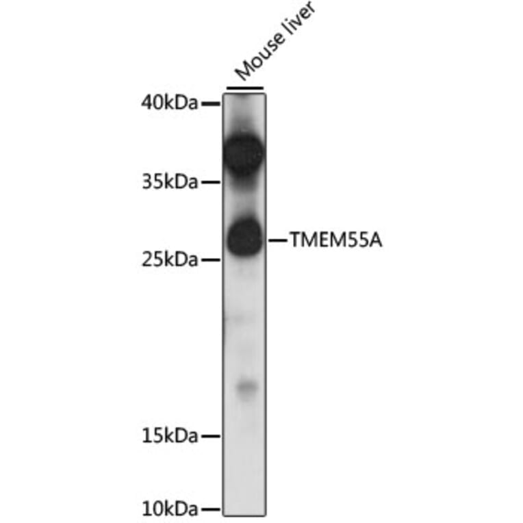 Western Blot - Anti-PIP4P2 Antibody (A89071) - Antibodies.com
