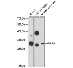 Western Blot - Anti-VAPA Antibody (A89072) - Antibodies.com