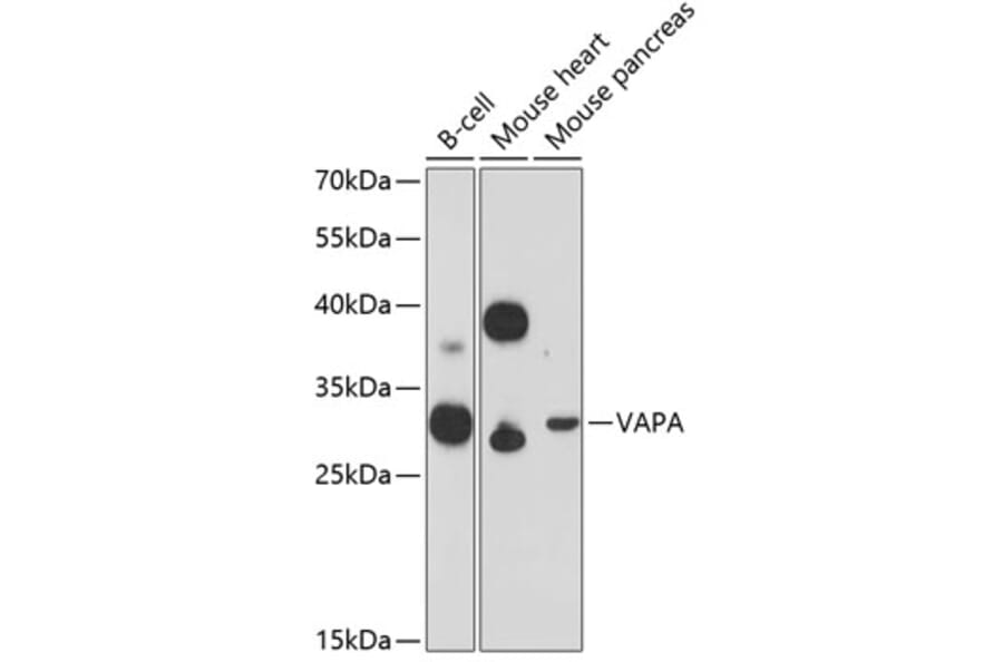 Western Blot - Anti-VAPA Antibody (A89072) - Antibodies.com