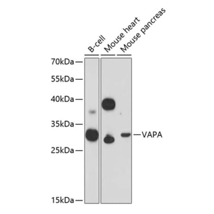 Western Blot - Anti-VAPA Antibody (A89072) - Antibodies.com