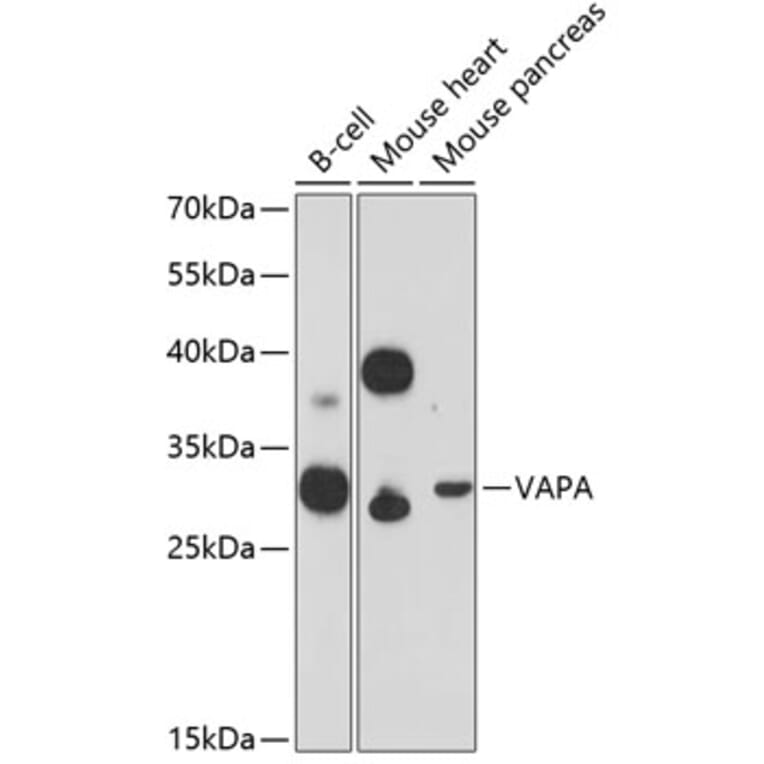 Western Blot - Anti-VAPA Antibody (A89072) - Antibodies.com