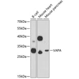 Western Blot - Anti-VAPA Antibody (A89072) - Antibodies.com