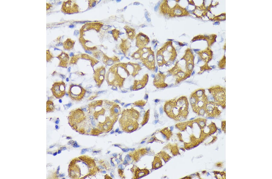 Immunohistochemistry - Anti-VAPA Antibody (A89072) - Antibodies.com