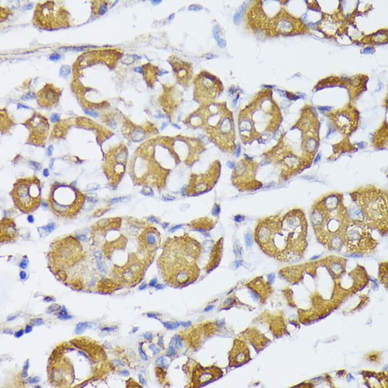 Immunohistochemistry - Anti-VAPA Antibody (A89072) - Antibodies.com