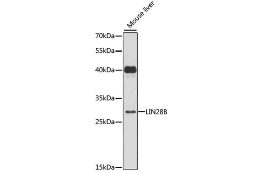 Western Blot - Anti-Lin28B Antibody (A89073) - Antibodies.com