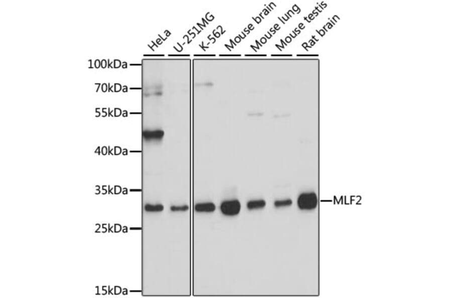 Western Blot - Anti-MLF2 Antibody (A89074) - Antibodies.com