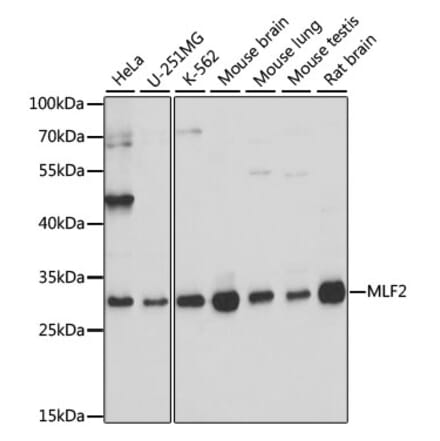 Western Blot - Anti-MLF2 Antibody (A89074) - Antibodies.com