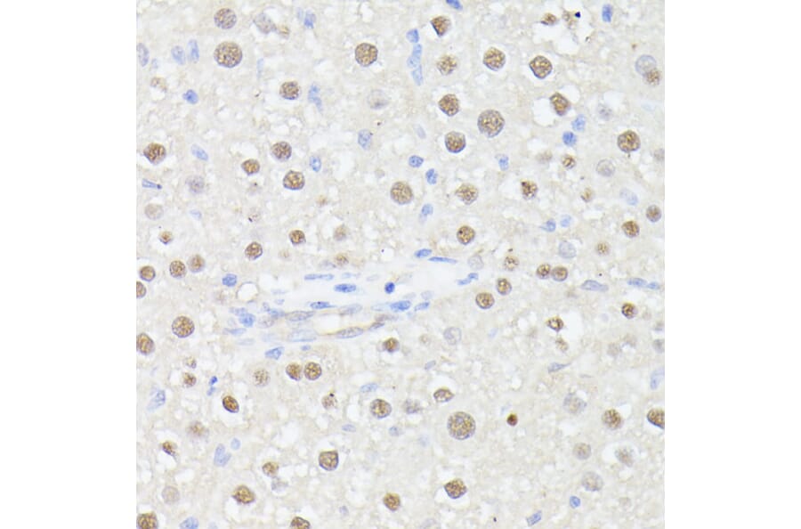 Immunohistochemistry - Anti-MLF2 Antibody (A89074) - Antibodies.com