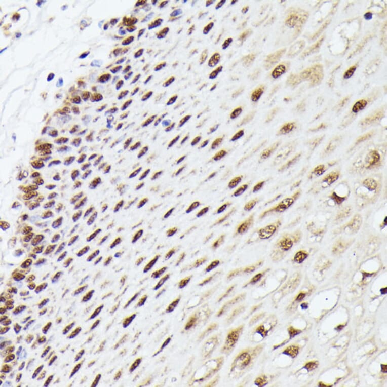 Immunohistochemistry - Anti-MLF2 Antibody (A89074) - Antibodies.com
