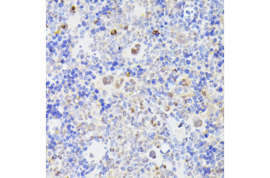 Immunohistochemistry - Anti-MLF2 Antibody (A89074) - Antibodies.com