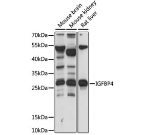 Western Blot - Anti-IGFBP4 Antibody (A89075) - Antibodies.com
