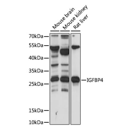 Western Blot - Anti-IGFBP4 Antibody (A89075) - Antibodies.com