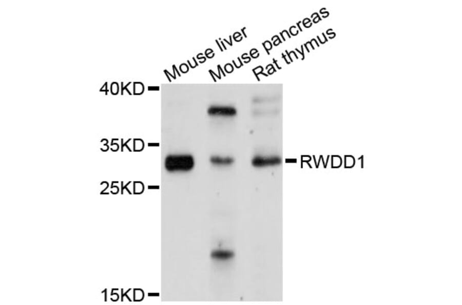 Western Blot - Anti-RWDD1 Antibody (A9237) - Antibodies.com