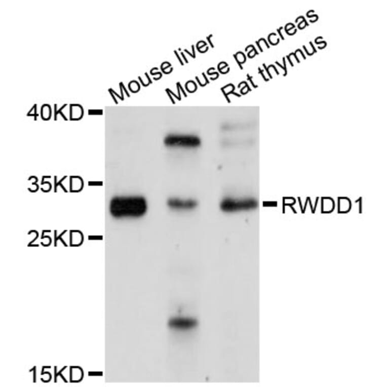 Western Blot - Anti-RWDD1 Antibody (A9237) - Antibodies.com