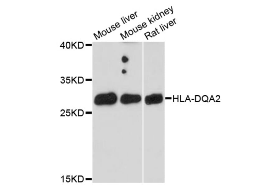 Western Blot - Anti-HLA-DQA2 Antibody (A9761) - Antibodies.com