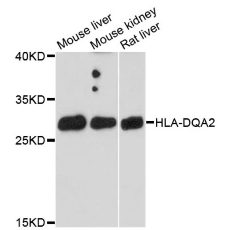 Western Blot - Anti-HLA-DQA2 Antibody (A9761) - Antibodies.com