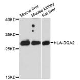 Western Blot - Anti-HLA-DQA2 Antibody (A9761) - Antibodies.com