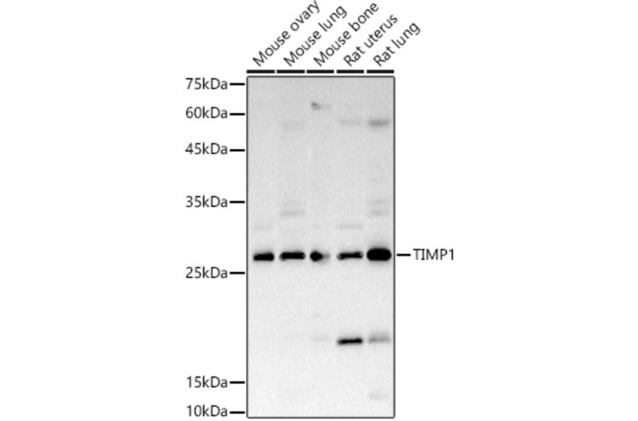 Western Blot - Anti-TIMP1 Antibody (A89078) - Antibodies.com