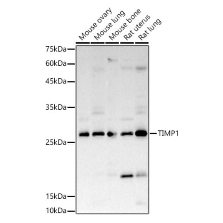 Western Blot - Anti-TIMP1 Antibody (A89078) - Antibodies.com