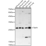 Western Blot - Anti-TIMP1 Antibody (A89078) - Antibodies.com