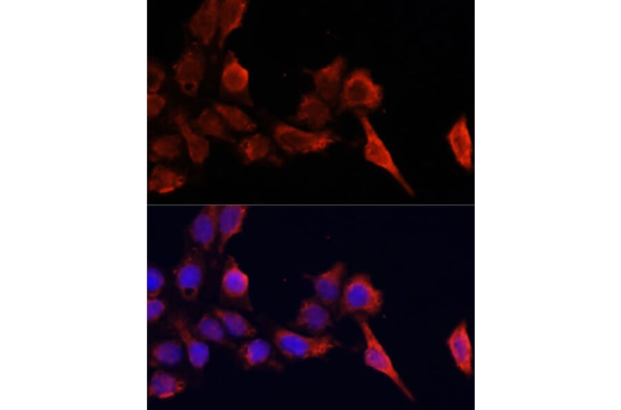 Immunofluorescence - Anti-TIMP1 Antibody (A89078) - Antibodies.com