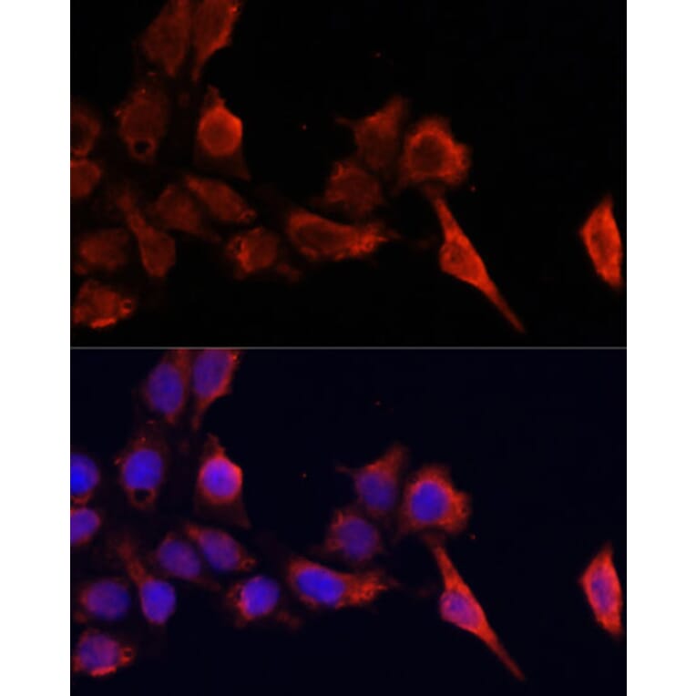 Immunofluorescence - Anti-TIMP1 Antibody (A89078) - Antibodies.com