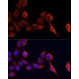Immunofluorescence - Anti-TIMP1 Antibody (A89078) - Antibodies.com