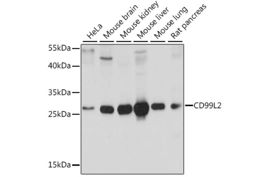 Western Blot - Anti-CD99L2 Antibody (A89079) - Antibodies.com